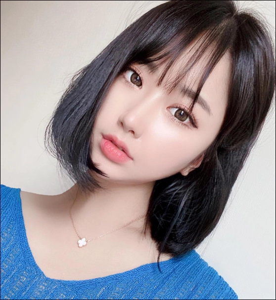眼部整形和开眼角整形一起后得到的完美眼型。