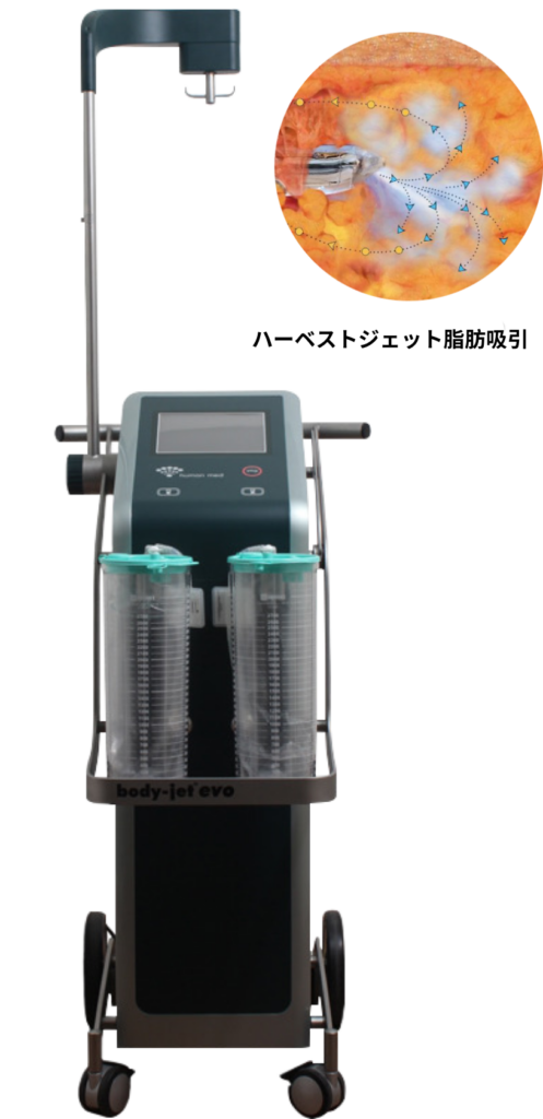 胸 脂肪注入に使用するbody-jet evoハーベストジェット装置の全体外観とウォータージェット脂肪吸引のイメージ。