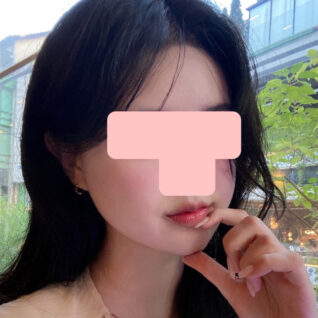 二重あご筋肉縛り